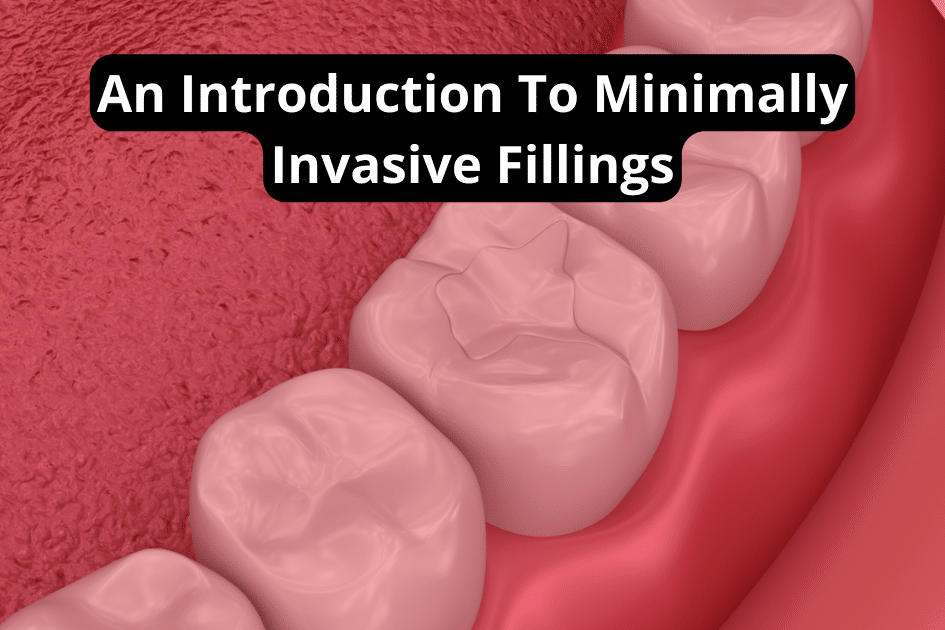 An Introduction to Minimally Invasive Fillings