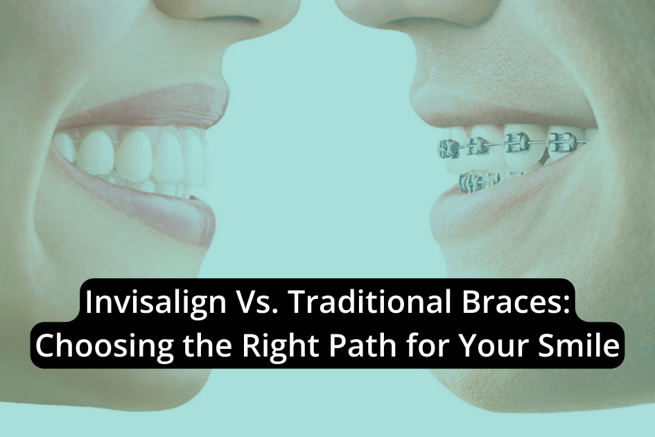 Invisalign vs Traditional Braces